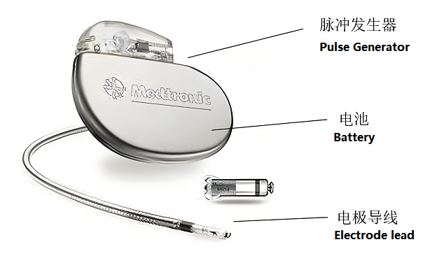 의료 기기의 리튬 배터리